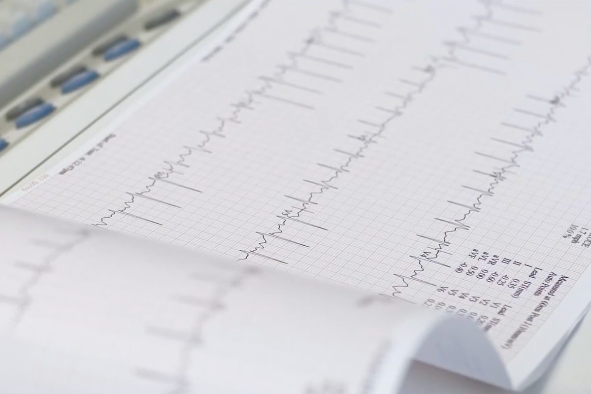 Heart Rhythm Disorders (Electrophysiology)