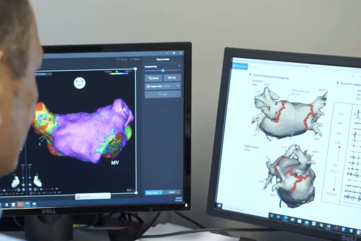 heart-rhythm-disorders-electrophysiology-3d electroanatomical mapping